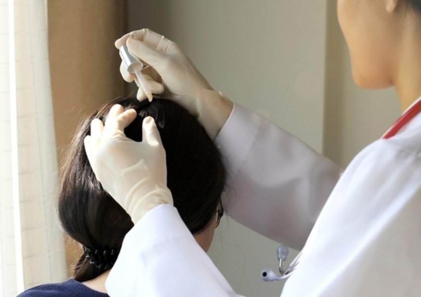 Anti Dandruff Treatment