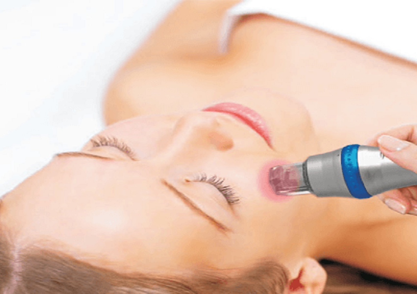 Fractional Microneedle radiofrequency