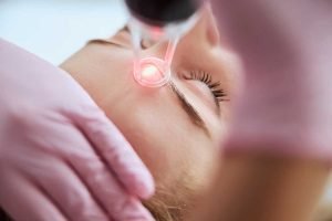Laser Treatment Bangalore