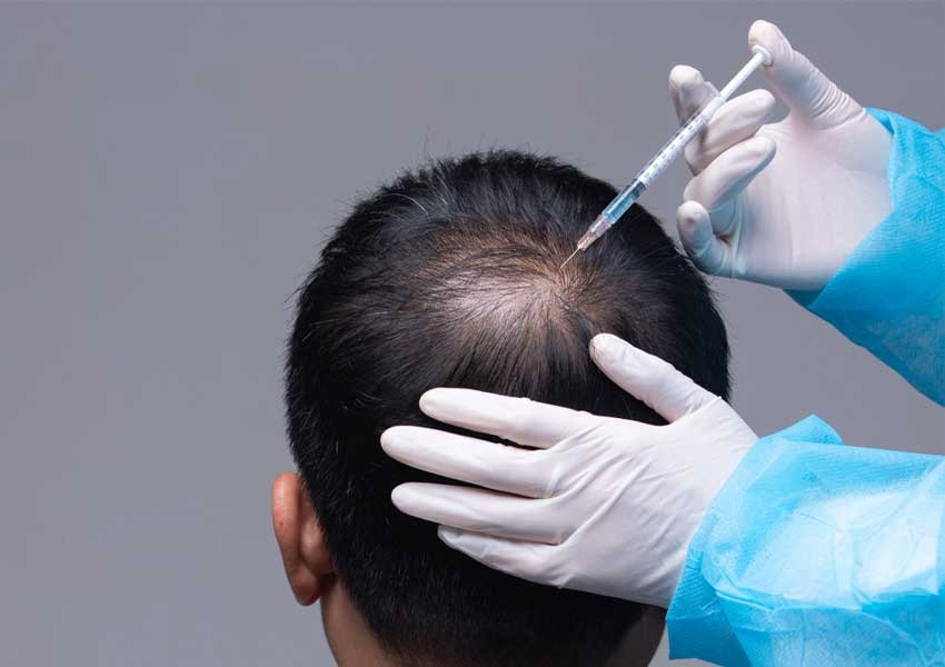 PRP Hair Treatment In Bangalore