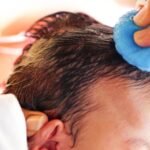 Hair Transplantation Clinic