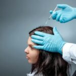 Hair Transplantation Clinic in Bangalore