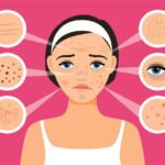 Common Skin Problems