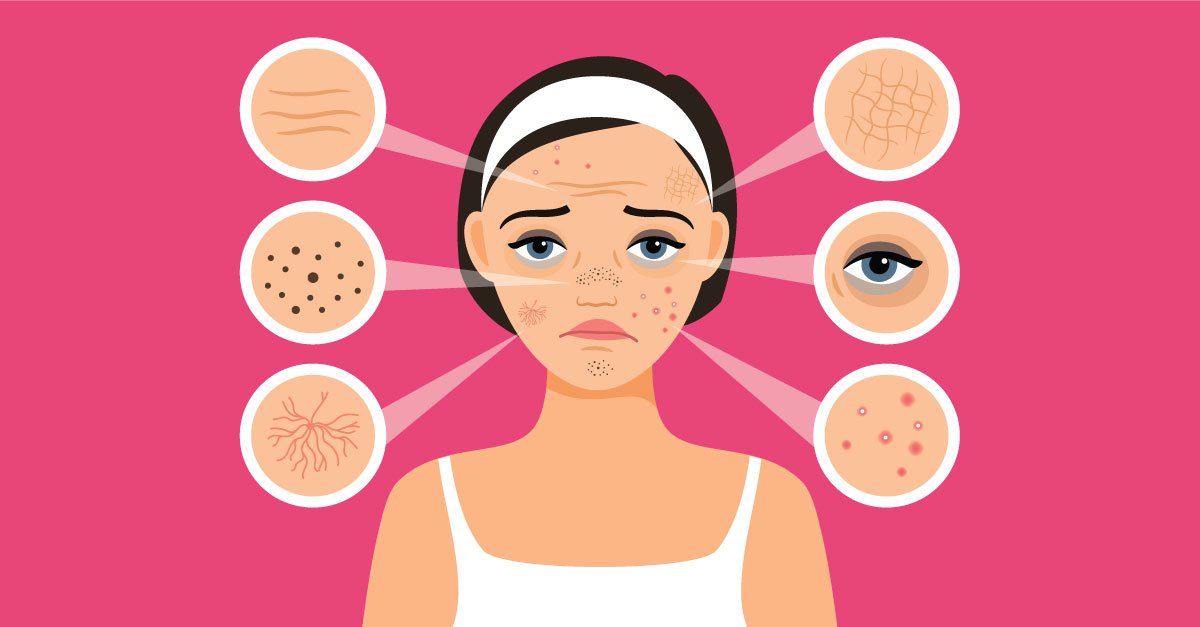 Common Skin Problems