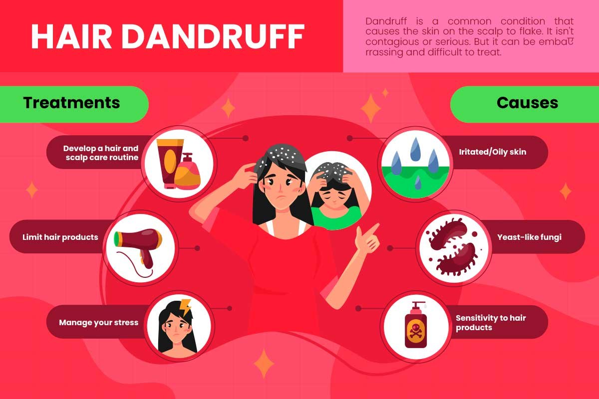 Anti Dandruff Treatment Bangalore