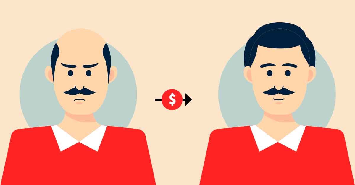 Hair Transplant Cost