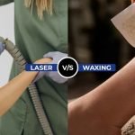 Laser vs. Waxing