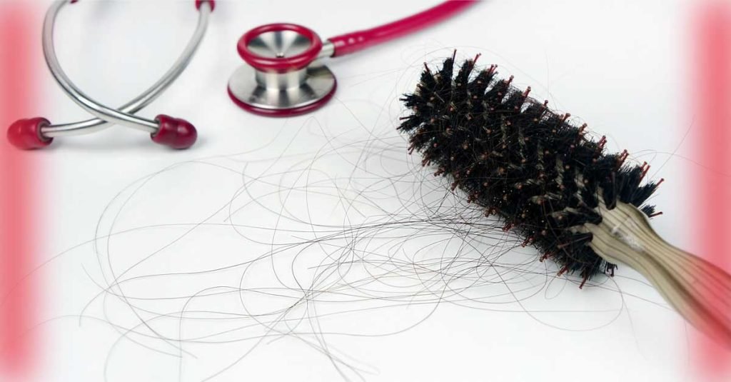 Hair Loss Diagnosis