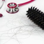 Hair Loss Diagnosis