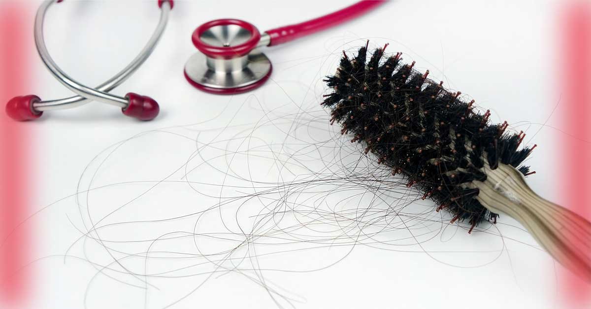 Hair Loss Diagnosis