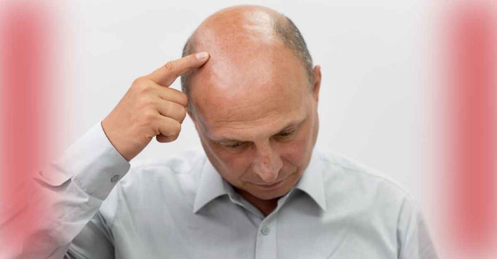 Men’s Hair Loss Treatments and Solutions