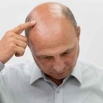 Men’s Hair Loss Treatments and Solutions