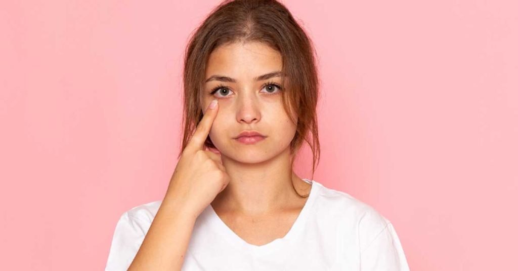 Dark Circle Treatment in Bangalore