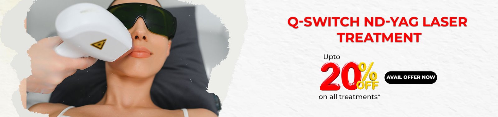 Q-Switch Nd-YAG Laser