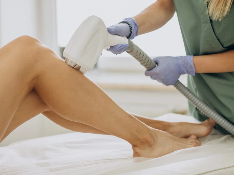 Laser Hair Removal