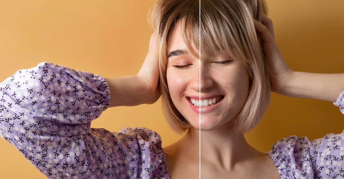 Exosomes vs PDRN_ Which Is Better for Skin Regeneration