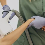 Laser Hair Removal Permanent