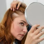 Hair Fall Treatment: Causes, Best Solutions & Dermatologist Guide