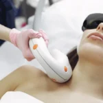 Laser Hair Removal: Benefits, Procedure, and Safety