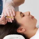 P-RP Hair Treatment