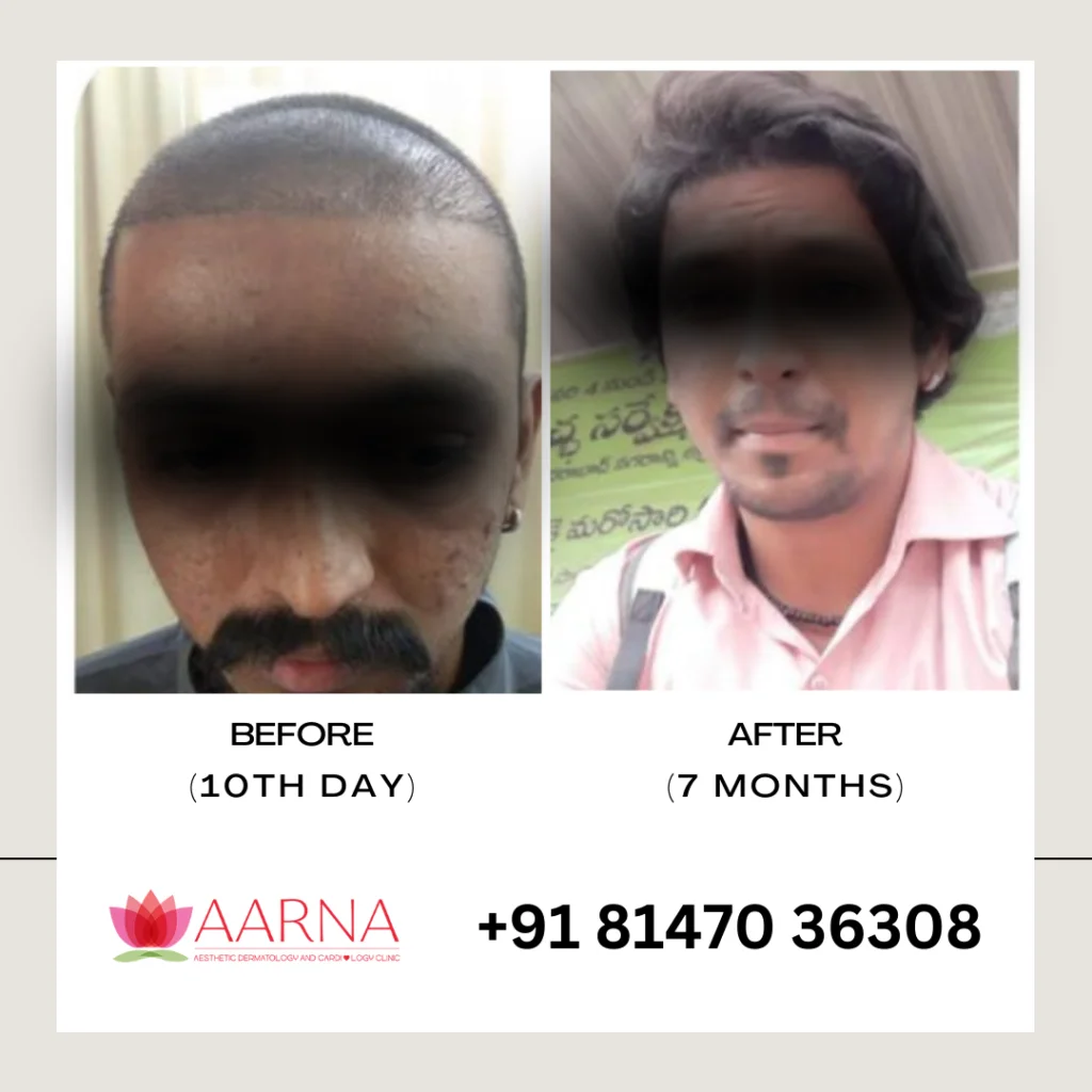 Real Results 2