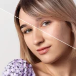 Melasma Vs Hyperpigmentation: What’s the Difference?