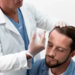 Mesotherapy for Hair Loss: Benefits, Procedure, and Cost