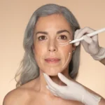 Best Non-Surgical Treatments to Reduce Wrinkles