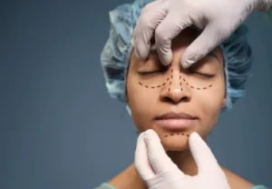 Thread Lift Treatment