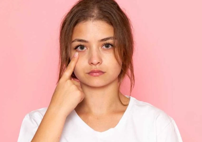 Dark Circles