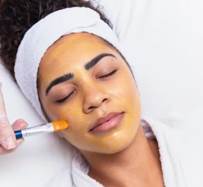 chemical peel