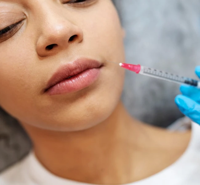 dermal fillers