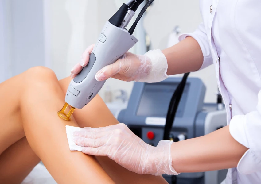 Laser Treatment