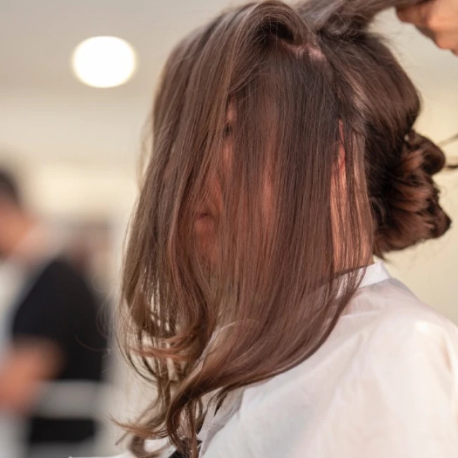 Hair Loss Treatment Bangalore