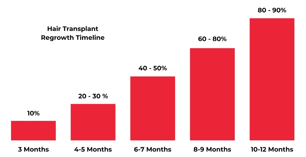 hair transplant stats
