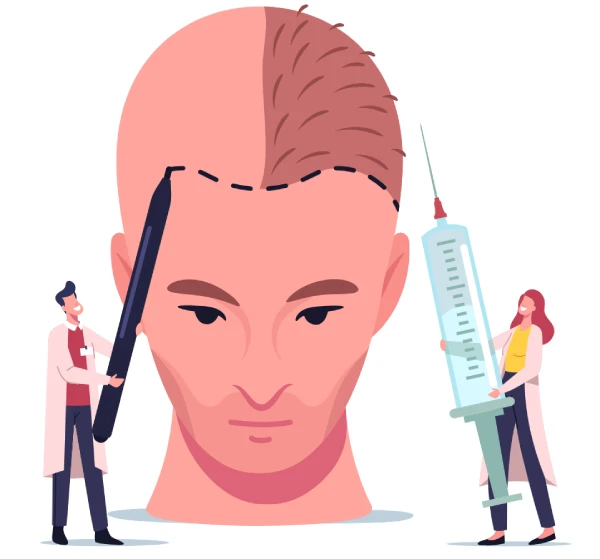 recovery process after hair transplant surgery