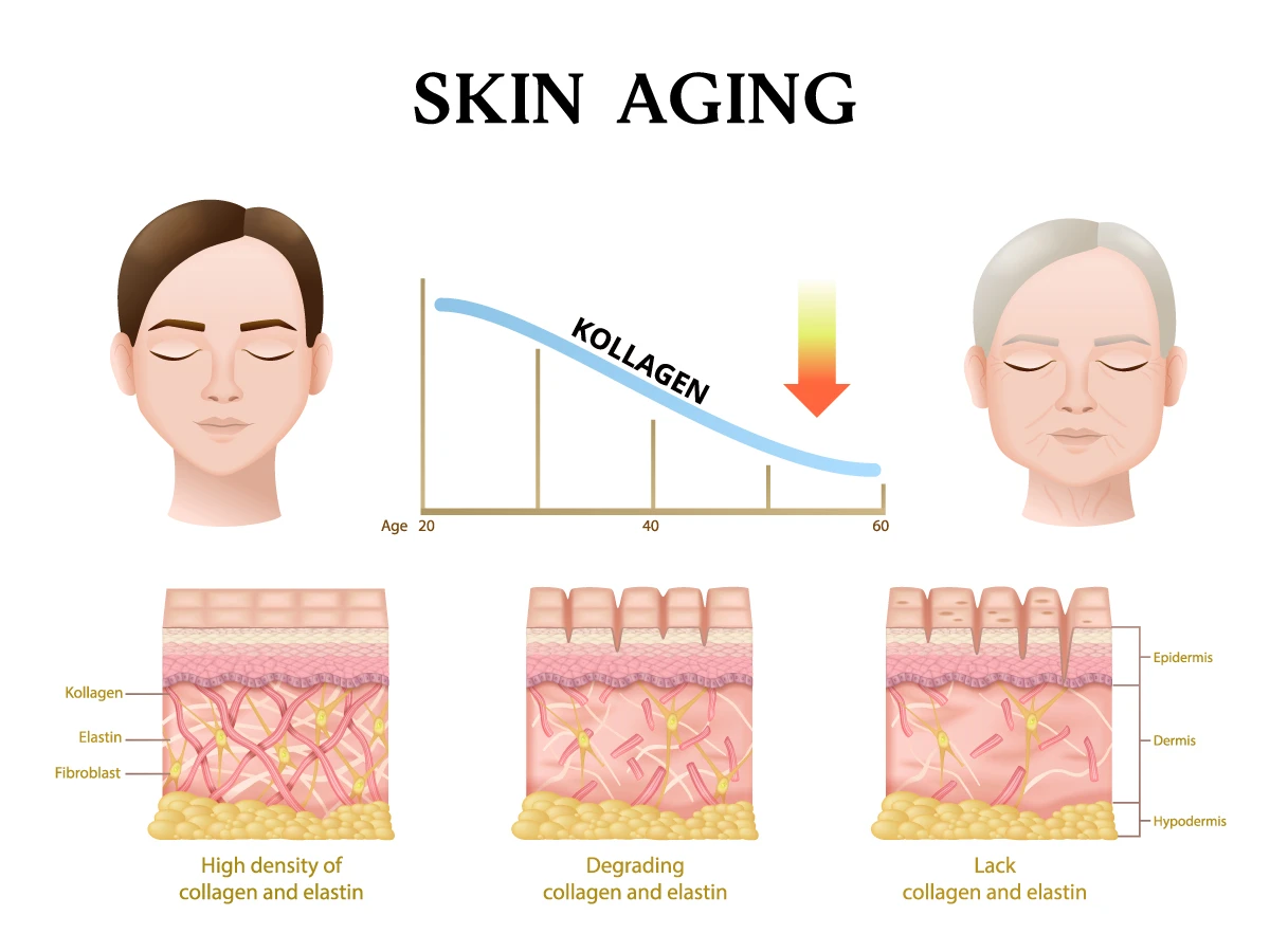 skin aging
